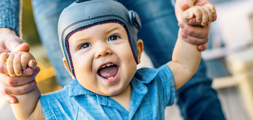 Baby mit wachstumslenkender Kopforthese